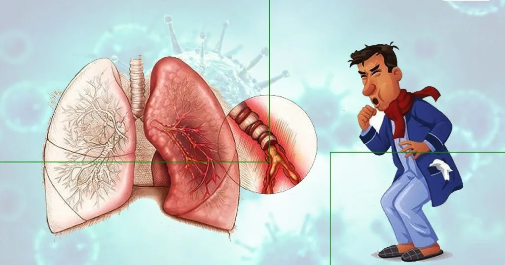 s Asthma A Communicable Disease
