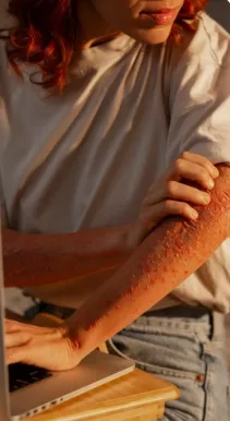 Allergy
