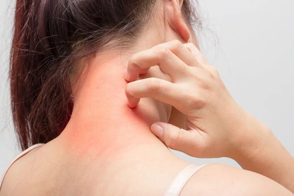 allergy treatment