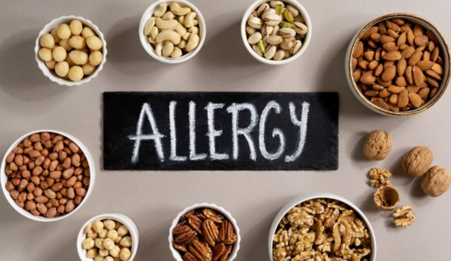 Allergy food
