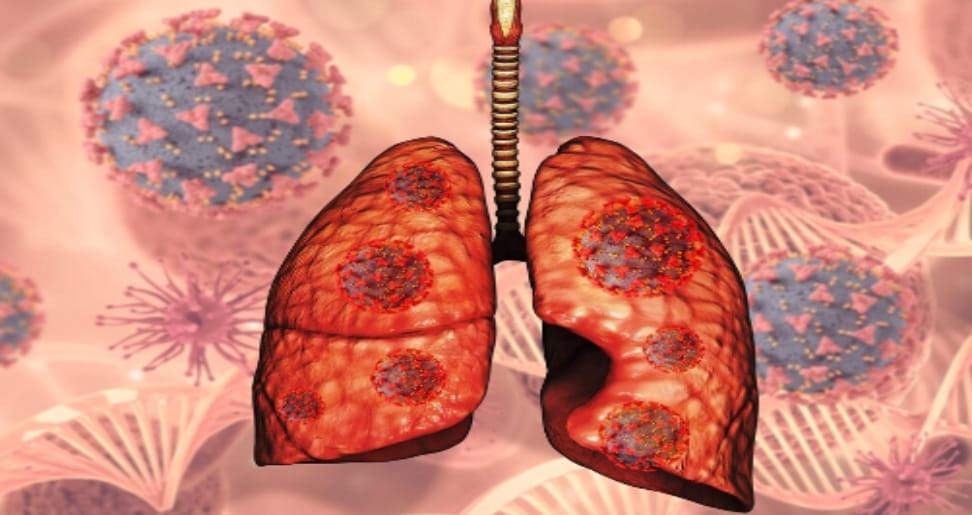 What Is a Pulmonary Function Test for Asthma? Everything You Need to Know