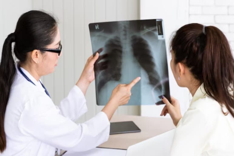 Why Do You Need a Pulmonary Function Test?
