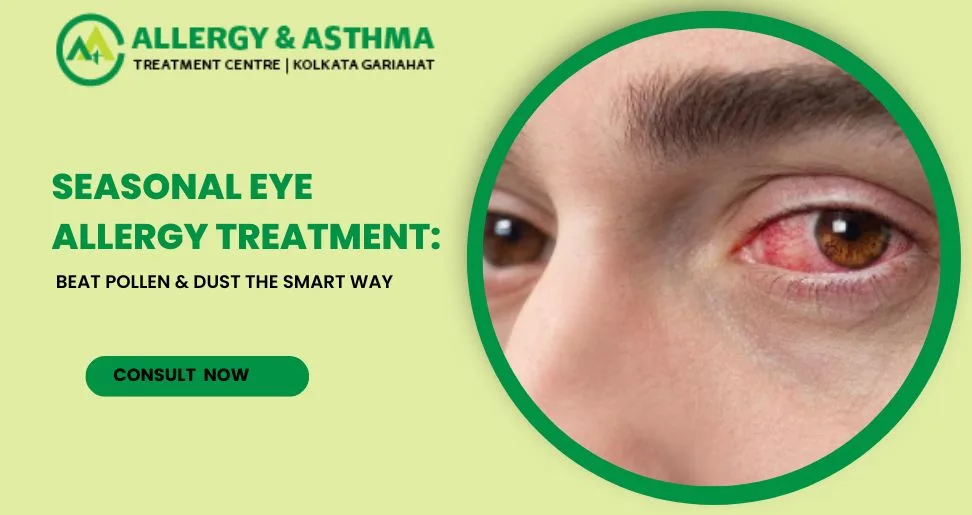 Seasonal Eye Allergy Treatment | Allergy Asthma