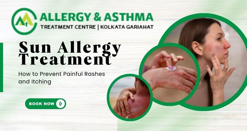 Sun Allergy Treatment: How to Prevent Painful Rashes and Itching | Asthma Allergy