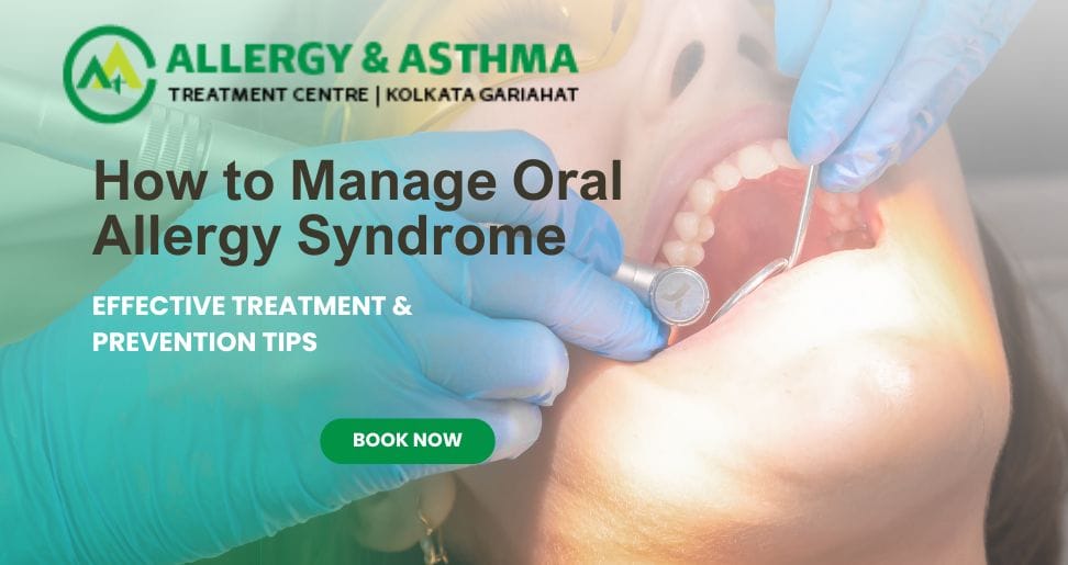 How to Manage Oral Allergy Syndrome: Effective Treatment & Prevention Tips | Allergy Asthma