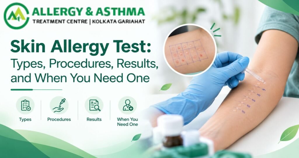 Skin Allergy Test | Allergy and Asthma Centre